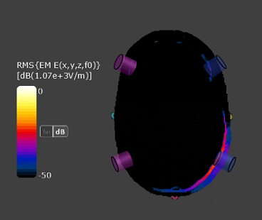 optimization to python | zmt zurich med tech Images... Automatic Head Model including 1010-System / Electrode Placement | ZMT ...