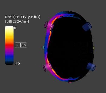 optimization to python | zmt zurich med tech Images... Automatic Head Model including 1010-System / Electrode Placement | ZMT ...