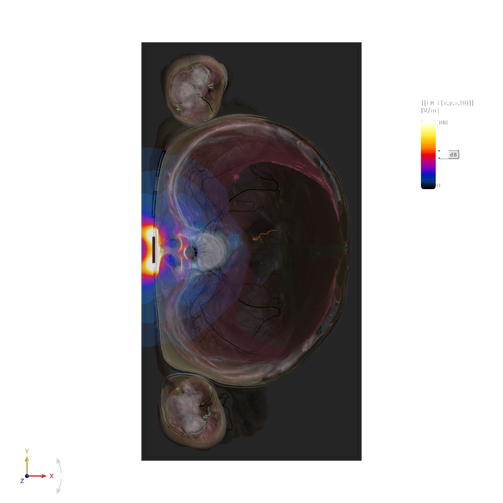10_hz_elecconfig_1_current_5mA_viewer_xy_jmagsliceviewer-002.png